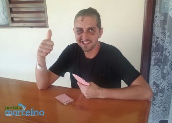 Jovem que ficou em coma após agressão se recupera e retorna para casa