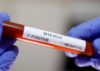 Marcelino Ramos registra o 3º caso de CORONAVÍRUS